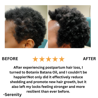 Batanic™️ Batana Natural Hair Growth Oil