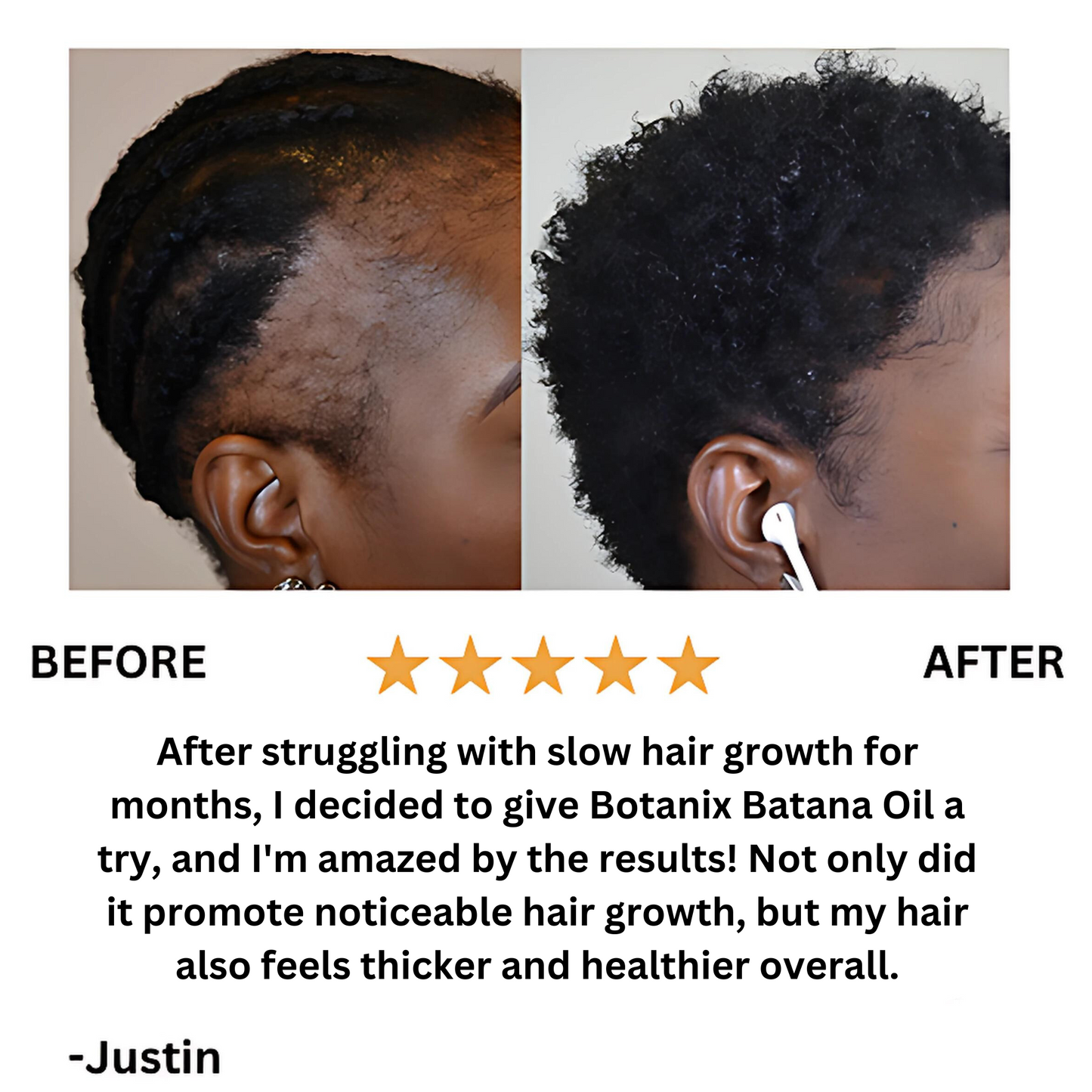 Batanic™️ Batana Natural Hair Growth Oil